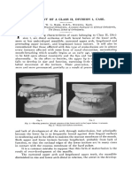 Treatment of A Class Ii, Division 1, Case