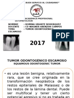 Tumor Odontogenico Escamoso