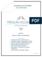 Ferulas Oclusales