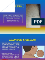 Acantosis Presentación