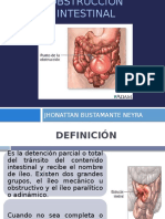 Obstruccion Intestinal