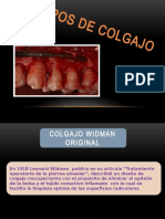 Tiposdecolgajo 130307200118 Phpapp01