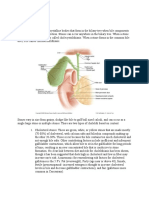 Cholelithiasis