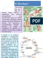 El Beriberi