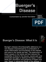 Buergers Disease PP