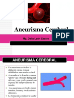 Aneurisma Cerebral Real