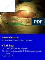 Enlarged Head Suffered Since 2 Mounths Before Admitted To ER, The Proses Is Slowly. There Were History of Seizure Once. No History of Vomiting