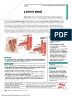 PDF Estenosis de Arteria Renal