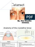 Cataract: By: Reci Maulita I11110032