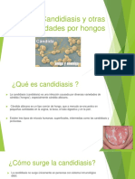 Candidiasis y Enfermedades Por Hongos en La Cavidad Bucal