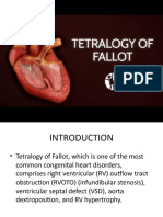 Tetralogy of Fallot