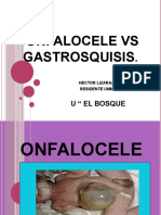 Onfalocelegastrosquisis2012 121209212928 Phpapp02