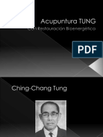 Acupuntura Tung