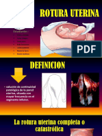 Rotura Uterina Expo