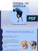 Protesis Rodilla Ss