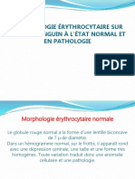 Morphologie Érythrocytaire Sur Frottis Sanguin À L'état Normal