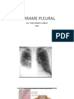 Derrame Pleural 