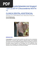 Patologia Leucoedema