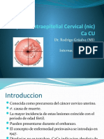 Neoplasia Intraepitelial Cervical (Nic)