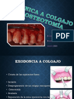 Tecnica A Colgajo y Osteotomia y Odontoseccion