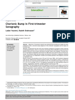 Chorionic Bump in First-Trimester Sonography: Sciencedirect