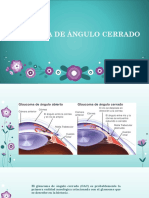 Glaucoma de Ángulo Cerrado o Estrecho