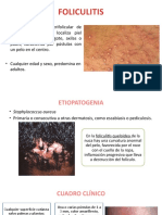 Foliculitis