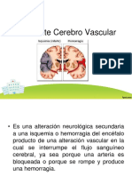 Accidente Cerebro Vascular