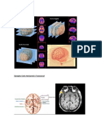 Cortes Del Cerebro