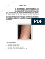 Queratosis Pilaris