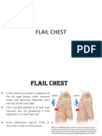 Flail Chest