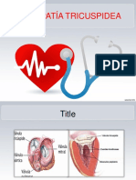 Insuficiencia - Estenosis Tricuspidea