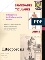 Osteoporosis