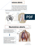 Neomotorax Lei