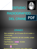 Craneo