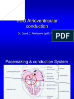 09 ECG Atrioventricular Conduction