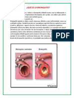 Qué Es La Bronquitis