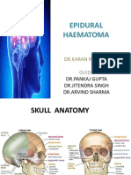 Epidural Haematoma: DR - Karan R Rawat