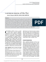 Chemical Burns of The Eye: Denise R. Ramponi, DNP, FNP-C, ENP-BC, FAEN, FAANP, CEN