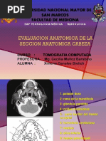 Anatomia Del Cerebro UNMSM