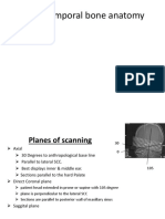 HRCT Temporal Bone Anatomy