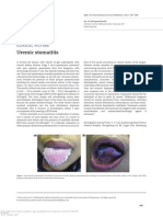 Uremic Stomatitis