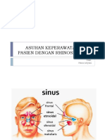 Asuhan Keperawatan Pada Pasien Dengan Rhinosinusitis: Oleh: Hana Ariyani