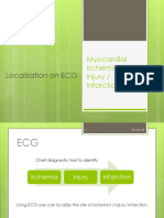 Localization On ECG: Myocardial Ischemia / Injury / Infarction