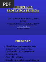 06 Hiperplasia Prostática Benigna - Dr. Flores