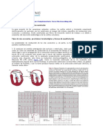   Vías Accesorias y Preexcitación Ventricular