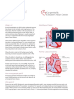 Atrial Septal Defect