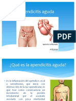 Apendicitis Aguda