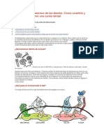 El Proceso Del Deterioro de Los Dientes