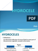 Hydrocele